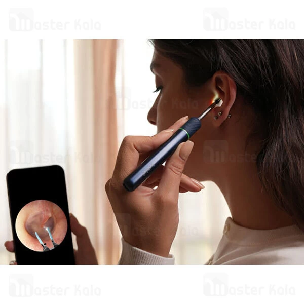 گوش پاک کن هوشمند شیائومی Xiaomi Bebird Note 5
