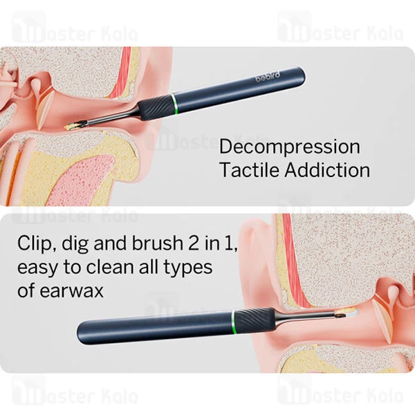 گوش پاک کن هوشمند شیائومی Xiaomi Bebird Note 5