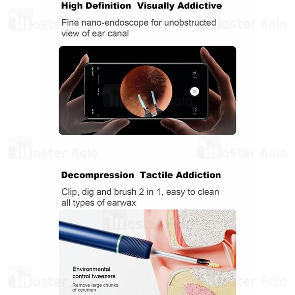 گوش پاک کن هوشمند شیائومی Xiaomi Bebird Note 5 Pro