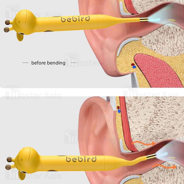 گوش پاک کن هوشمند شیائومی Xiaomi Bebird D3 Pro Smart Visual Ear Cleaning Tool