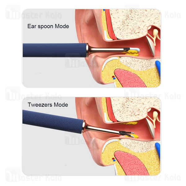 گوش پاک کن هوشمند شیائومی Xiaomi Bebird Note 3 Pro