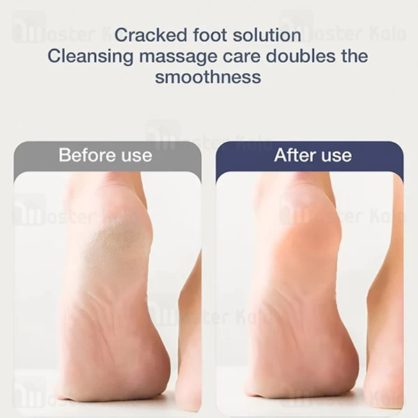 سنگ پا شارژی شیائومی انچن Enchen Rock