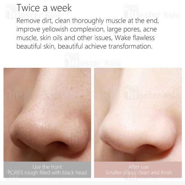 دستگاه پاک کننده صورت Xiaomi WellSkins WX-HT100 Electric Blackhead Cleaner Facial Deep