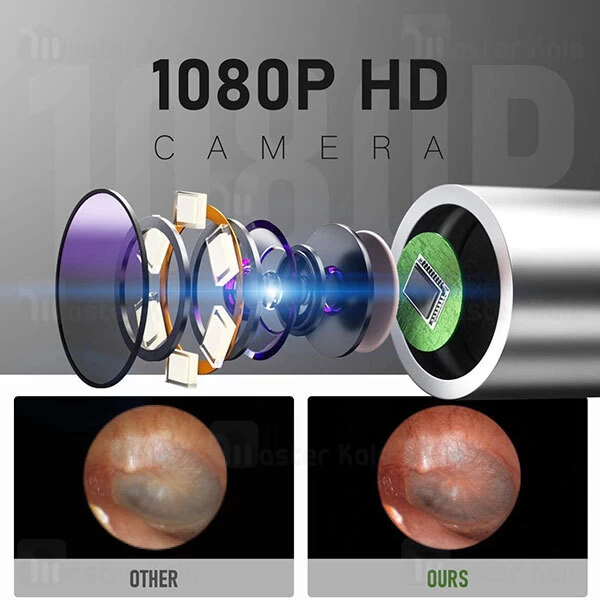 گوش پاک کن هوشمند Xiaomi Bebird C3 Intelligent Visual Ear Cleaner