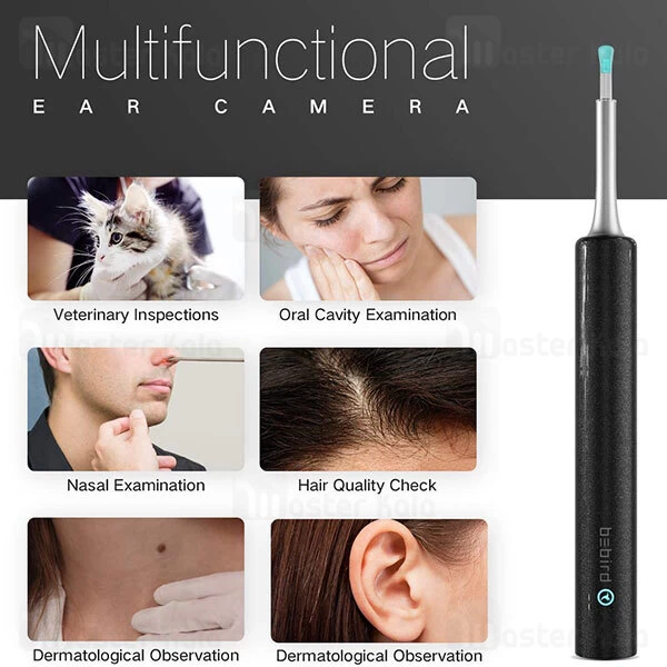 گوش پاک کن هوشمند Xiaomi Bebird C3 Intelligent Visual Ear Cleaner