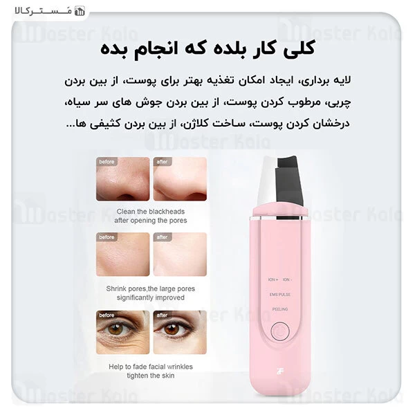 دستگاه پاک کننده صورت Xiaomi MS7100 inFace Ultrasonic Ion Acne Cleansing
